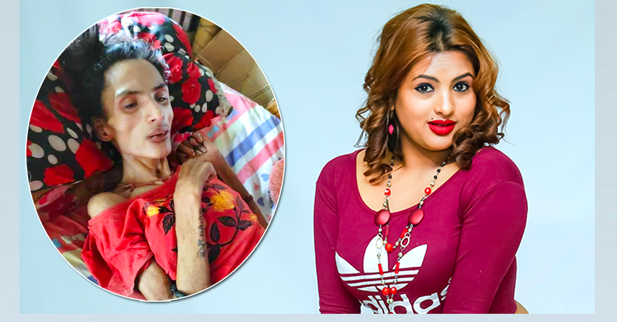 तीन महिना देखि मोडल निशाको उपचार गरेको नर्भिक अस्पताल किन भयो निरास ? पत्रकार सम्मेलन गर्दै यस्तो भन्यो