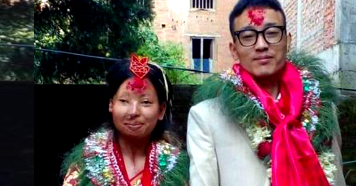 एसिडले जलेकी संगिताको गासियो लगनगाठो ।