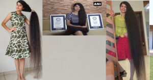 यी हुन् विश्वमै सबैभन्दा लामो कपाल भएकी युवती