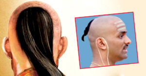 टुप्पी (शिखा) किन राखिन्छ ?