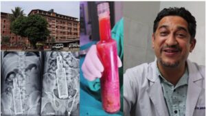 पेटभित्र कसरी आयो रक्सीको सिँगो बोतल, चकित परे डाक्टर, चितवनमै भयो ठुलो अप्रेशन